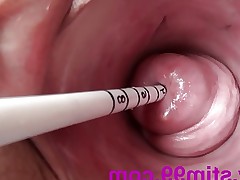 Extreme Real Cervix Fucking Insertion Objects in